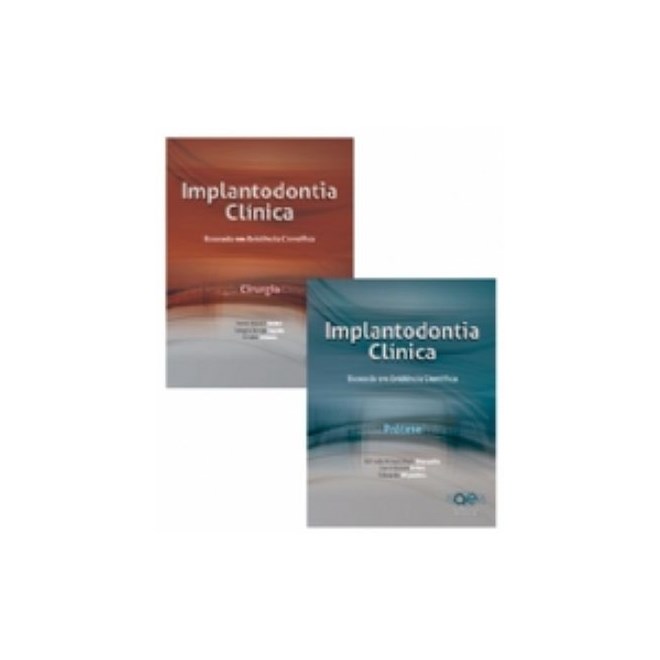 Livro - Implantodontia Vol. 1 - Clinica Baseada em Evidencia Cientifica - Cirurgia - Shibli/jayme/zetola