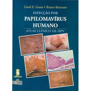 Livro - Infecção por Papilomavírus Humano - Atlas Clínico de HPV - Gross
