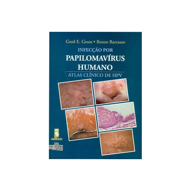 Livro - Infeccao por Papilomavirus Humano - Atlas Clinico de Hpv - Gross/barrasso