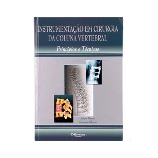 Livro - Instrumentacao em Cirurgia da Coluna Vertebral - Harms