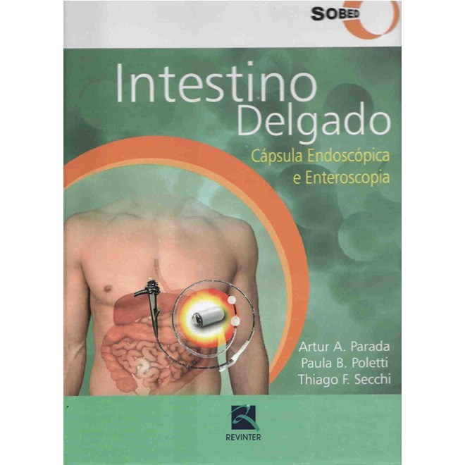 Livro - Intestino Delgado: Capsula Endoscopica e Enteroscopia - Parada/poletti/secch