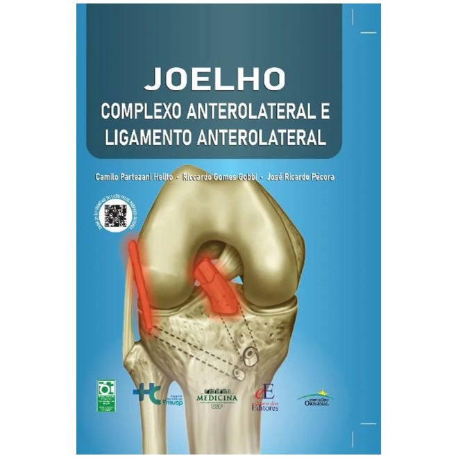 Livro - Joelho: Complexo Anterolateral e Ligamento Anterolateral - Helito/gobbi/pecora