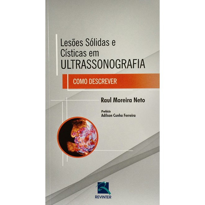 Livro - Lesoes Solidas e Cisticas em Ultra - Como Descrever - Raul Moreira Neto
