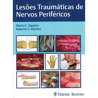 Livro Lesões Traumáticas de Nervos Periféricos - Siqueira - Revinter
