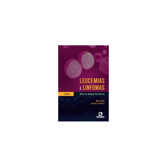 Livro Leucemias e Linfomas - Atlas do Sangue Periférico - Melo - Rúbio