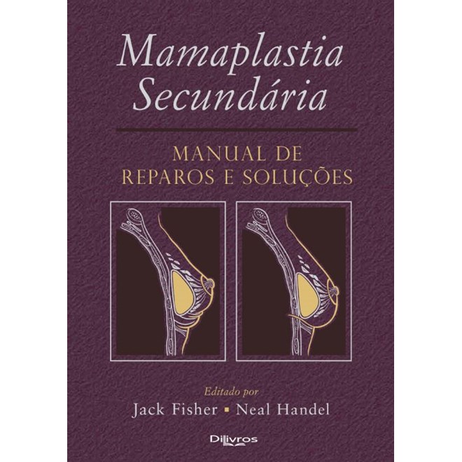 Livro - Mamaplastia Secundaria Manual de Reparos e Solucoes - Fisher/handel