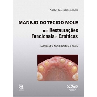Livro - Manejo do Tecido Mole Nas Restauracoes Funcionais e Esteticas Conceitos E - Raigrodski