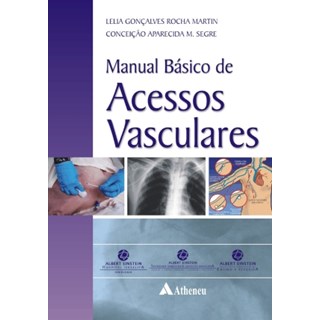 Livro Manual Básico de Acessos Vasculares - Martin