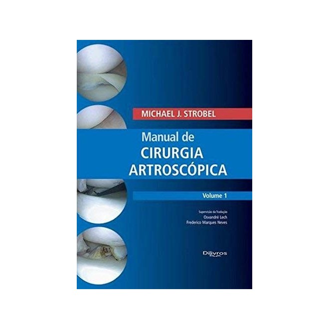 Livro - Manual de Cirurgia Artroscopica: Vol. 1 - Strobel