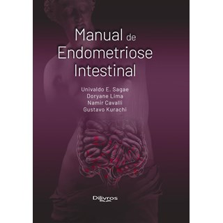 Livro - Manual de Endometriose Intestinal - Sagae