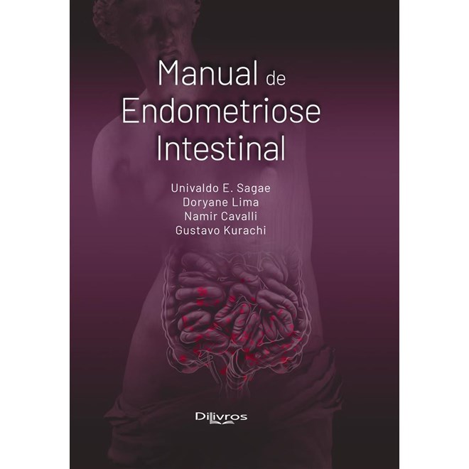 Livro - Manual de Endometriose Intestinal - Sagae