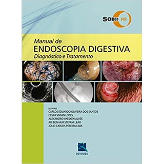 Livro - Manual de Endoscopia Digestiva: Diagnostico e Tratamento - Santos/lopes/ Alves