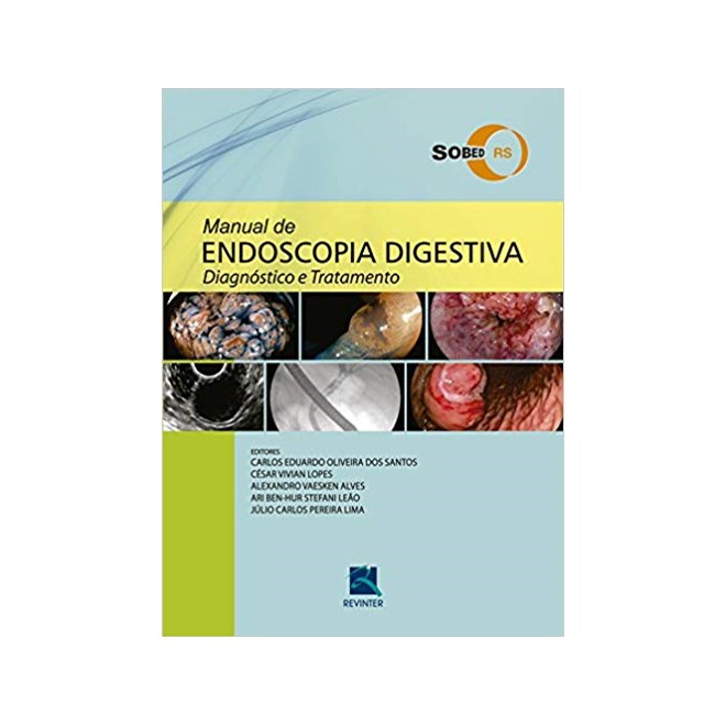 Livro - Manual de Endoscopia Digestiva: Diagnostico e Tratamento - Santos/lopes/ Alves