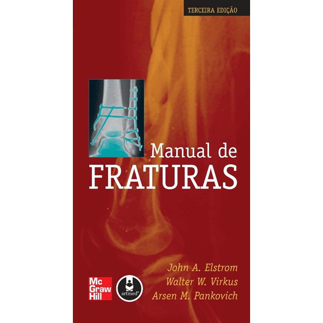 Livro - Manual de Fraturas - Elstrom/virkus/panko