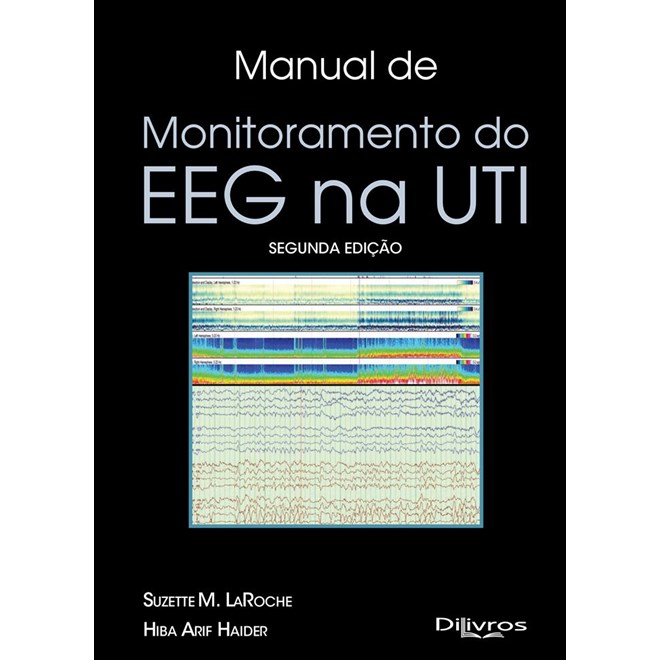 Livro - Manual de Monitoramento do Eeg Na Uti - Laroche/haider
