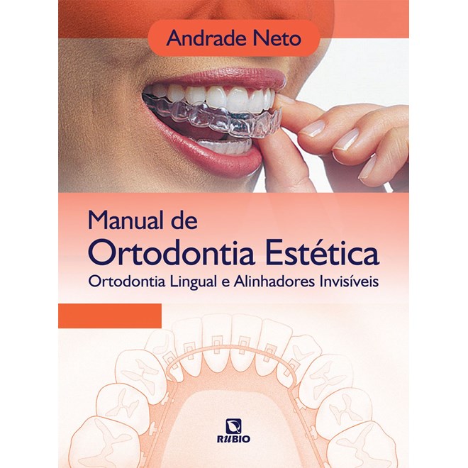 Livro - Manual de Ortodontia Estética Ortodontia Lingual e Alinhadores Invisíveis - Andrade Neto