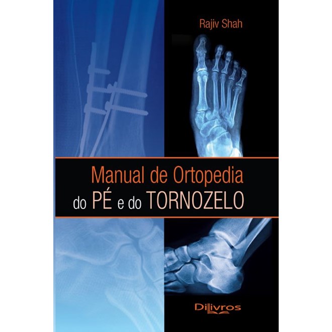 Livro - Manual de Ortopedia do pe e do Tornozelo - Shah