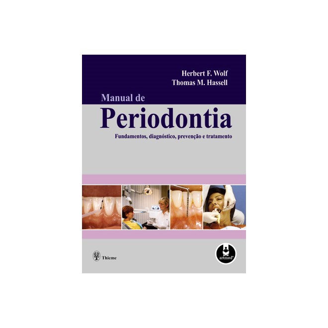 Livro - Manual de Periodontia - Fundamentos, Diagnostico, Prevencao e Tratamento - Wolf/hassell