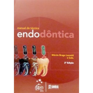 Livro - Manual de Técnica Endodôntica - Lauretti Livro - Manual de Técnica Endodôntica - Lauretti