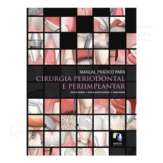 Livro - Manual Pratico de Cirurgia Periodontal e Periimplantar - Cimoes