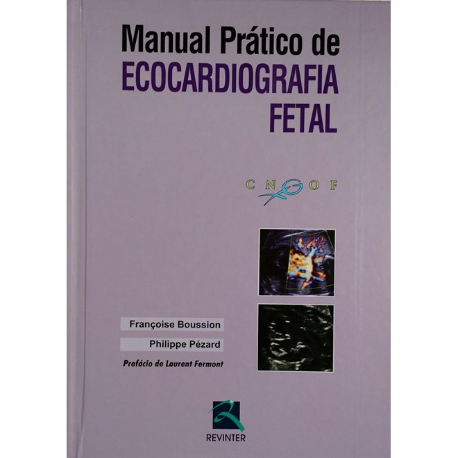 Livro - Manual Pratico de Ecocardiografia Fetal - Boussion/pezard