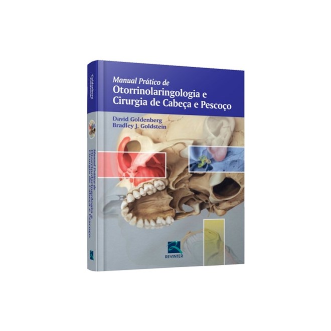 Livro - Manual Pratico de Otorrinolaringologia e Cirurgia de Cabeca e Pescoco - Goldenberg
