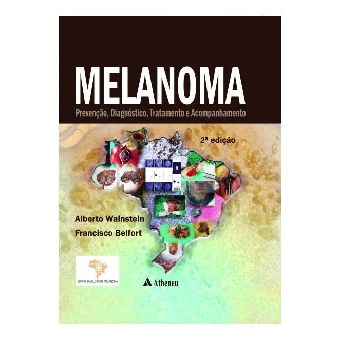 Livro - Melanoma - Prevencao, Diagnostico, Tratamento e Acompanhamento - Wainstein/belfort