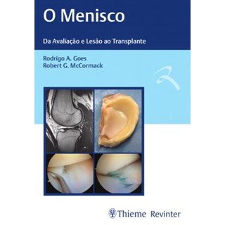 Livro - Menisco, O - Goes/mccormack