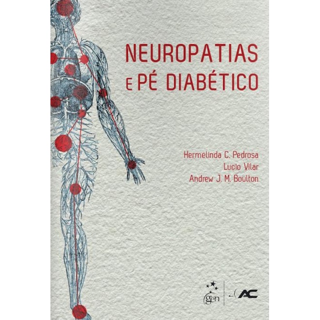 De diabética neuropatía periférica. médico la Manejo