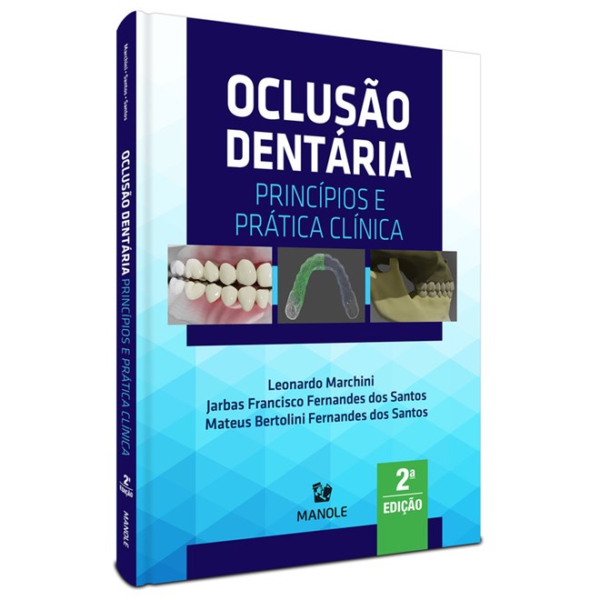 Livro Oclusão Dentária - Marchini - Manole
