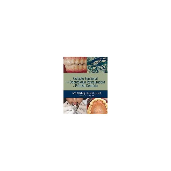 Livro - Oclusao Funcional em Odontologia Restauradora e Protese Dentaria - Klineberg