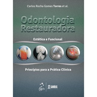 Livro - Odontologia Restauradora Estética e Funcional - Torres