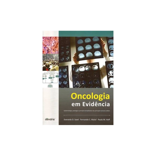 Livro - Oncologia em Evidencia - Saad/ Maluf/ Hoff