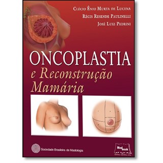 Livro Oncoplastia e Reconstrução Mamária SBM - Lucena - Medbook