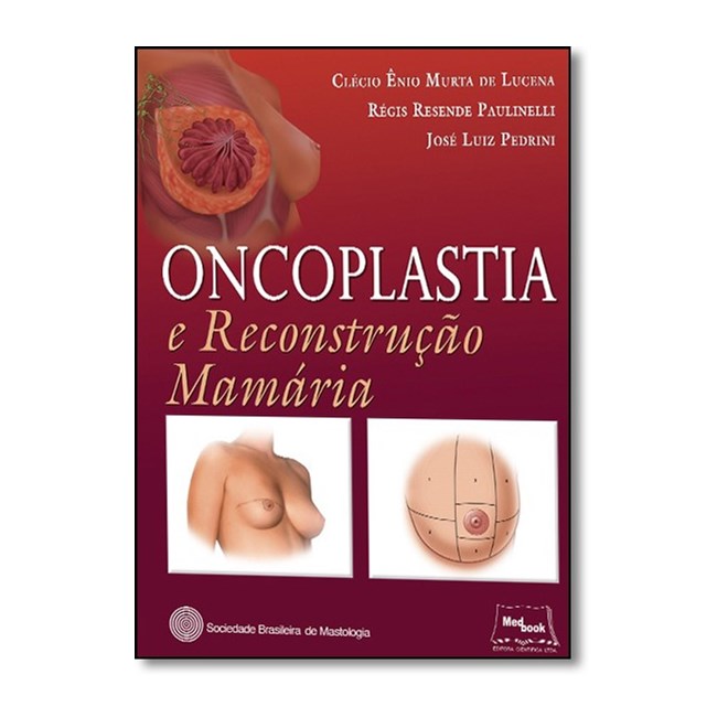 Livro Oncoplastia e Reconstrução Mamária SBM - Lucena - Medbook