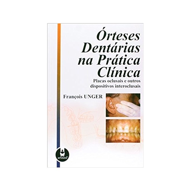 Livro Órteses Dentárias Na Prática Clínica - Unger - Artmed
