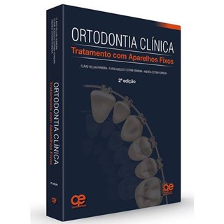 Livro - Ortodontia Clínica: Tratamento com Aparelhos Fixos - Vellini - Santos