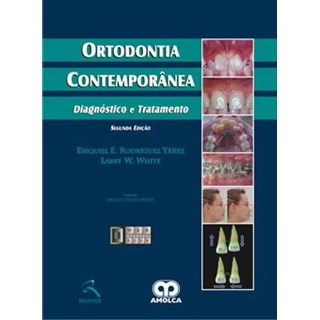 Livro - Ortodontia Contemporânea - Diagnóstico e Tratamento - Yanez