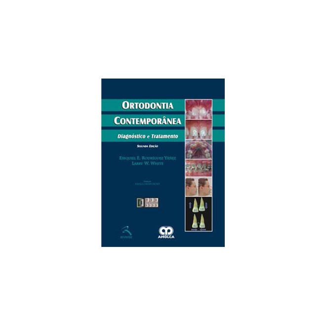 Livro - Ortodontia Contemporanea - Diagnostico e Tratamento - Yanez/ Qhite