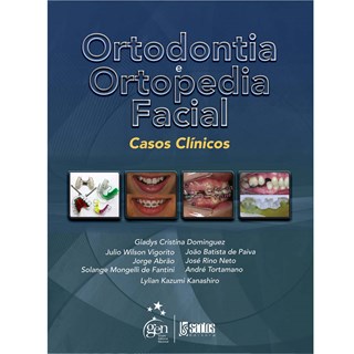 Livro - Ortodontia e Ortopedia Facial - Casos Clínicos - Dominguez