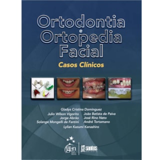 Livro - Ortodontia e Ortopedia Facial - Casos Clínicos - Dominguez Livro - Ortodontia e Ortopedia Facial - Casos Clínicos - Dominguez