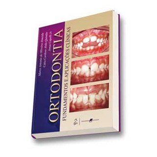 Livro Ortodontia Fundamentos e Aplicações Clínicas - Almeida - Guanabara