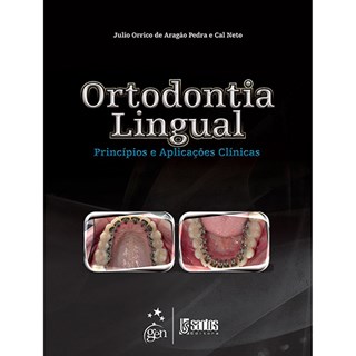 Livro - Ortodontia Lingual - Princípios e Aplicações Clínicas - Pedra