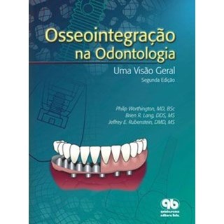 Livro - Osseointegracao Na Odontologia - Worthington