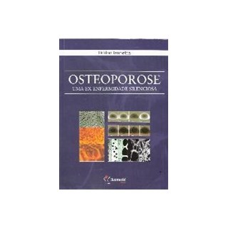 Livro - Osteoporose - Uma Ex-Enfermidade Silenciosa - Lannetta ***