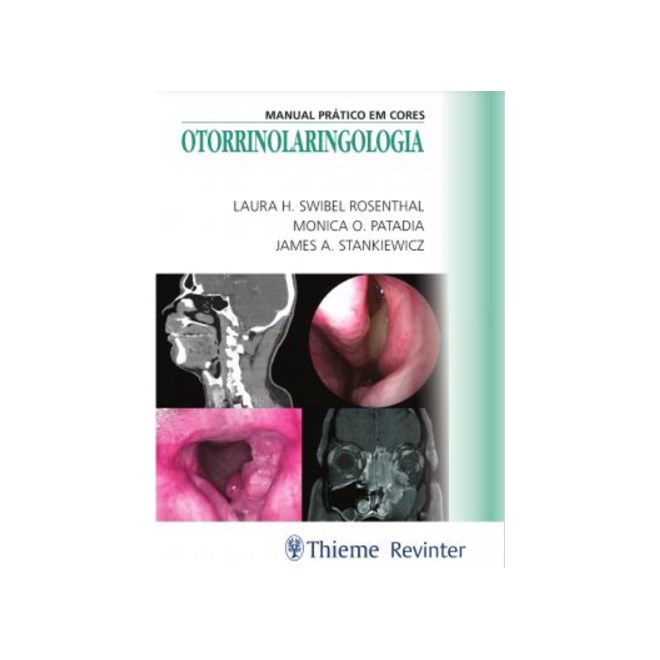 Livro - Otorrinolaringologia - Manual Pratico em Cores - Patadia/rosenthal