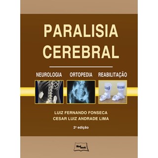 Livro Paralisia Cerebral Neurologia Ortopedia e Reabilitação - Fonseca - Medbook