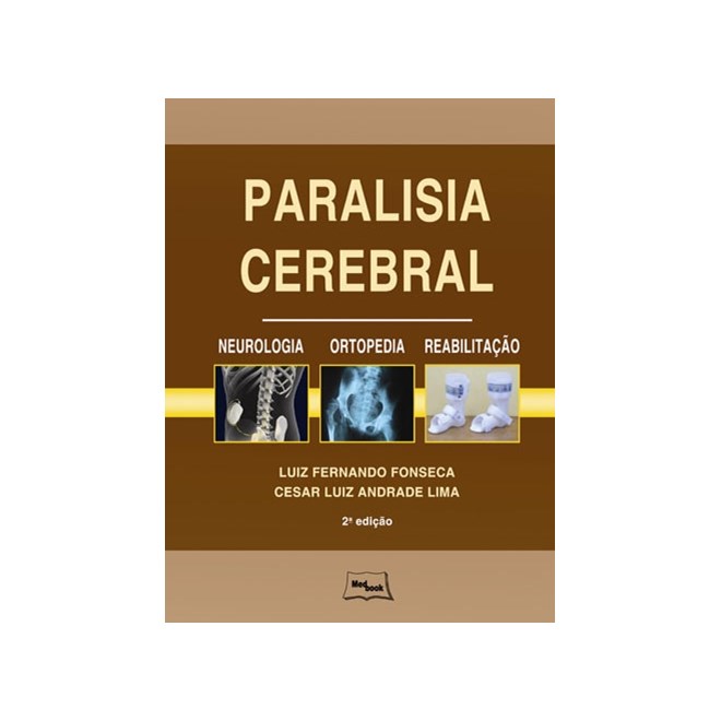 Livro Paralisia Cerebral Neurologia Ortopedia e Reabilitação - Fonseca - Medbook