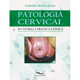Livro - Patologia Cervical -Da Teoria à Prática Clínica - Mortoza Jr.