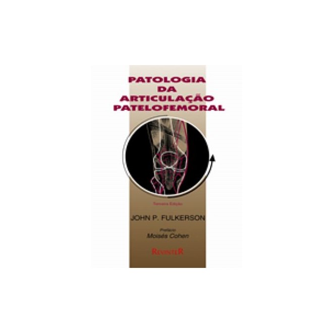 Livro - Patologia da Articulacao Patelofemoral - Fulkerson